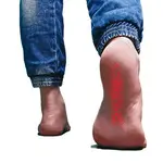 DIY plantar fasciitis cure treatments that you can try at home. Treat it quickly to cure it quickly.